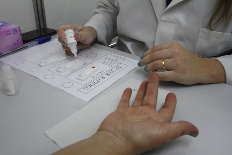 Cerca de 438 mil pessoas fazem tratamento contra HIV no SUS