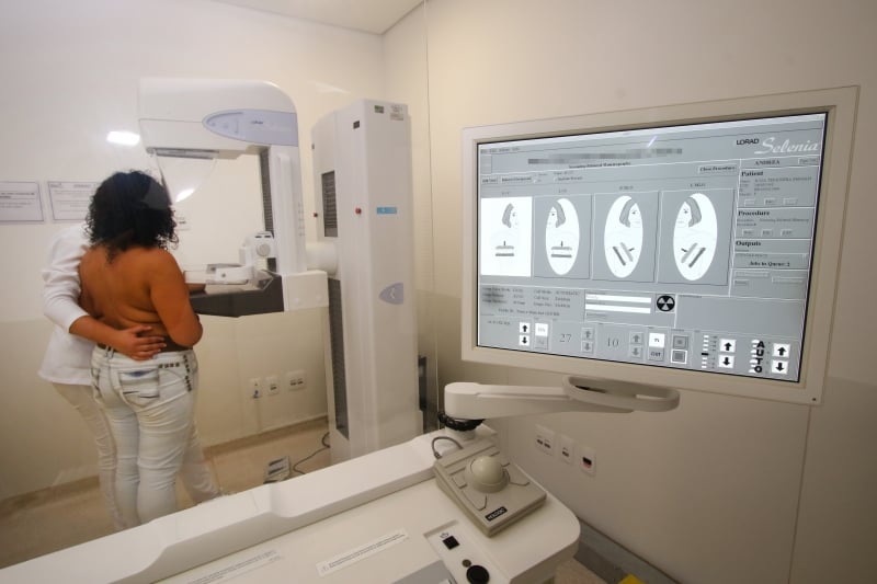 Em 2020, há queda de 36% na procura pela realização de mamografias na comparação com 2019 