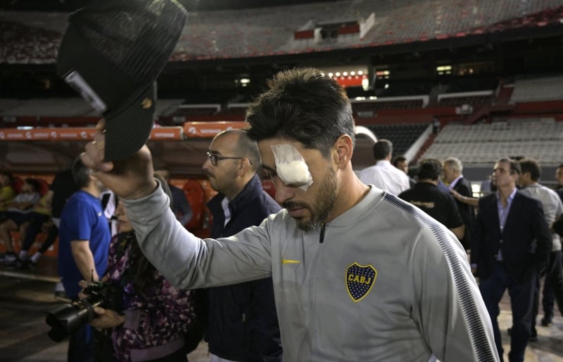 O jogador sofreu cortes no olho e no rosto após ataque a ônibus do Boca Juniors na véspera da decisão