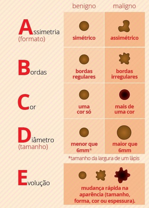 {'nm_midia_inter_thumb1':'https://www.jornaldocomercio.com/_midias/jpg/2019/12/06/206x137/1_ger___regra_do_abcde___cancer_de_pele___saude___melanoma___divulgacao_inca-8923857.jpg', 'id_midia_tipo':'2', 'id_tetag_galer':'', 'id_midia':'5deabd5eeb091', 'cd_midia':8923857, 'ds_midia_link': 'https://www.jornaldocomercio.com/_midias/jpg/2019/12/06/ger___regra_do_abcde___cancer_de_pele___saude___melanoma___divulgacao_inca-8923857.jpg', 'ds_midia': 'GER - Regra do ABCDE - c&acirc;ncer de pele - sa&uacute;de - melanoma - Divulga&ccedil;&atilde;o INCA', 'ds_midia_credi': 'inca/divulga&ccedil;&atilde;o/jc', 'ds_midia_titlo': 'GER - Regra do ABCDE - c&acirc;ncer de pele - sa&uacute;de - melanoma - Divulga&ccedil;&atilde;o INCA', 'cd_tetag': '1', 'cd_midia_w': '510', 'cd_midia_h': '712', 'align': 'Left'}