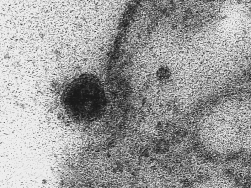 Fiocruz registrou o exato momento em que o vírus (ponto escuro) ataca a célula