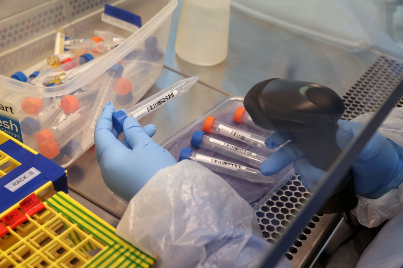Ministério da Saúde negocia a entrega de 1 milhão de exames do tipo RT-PCR