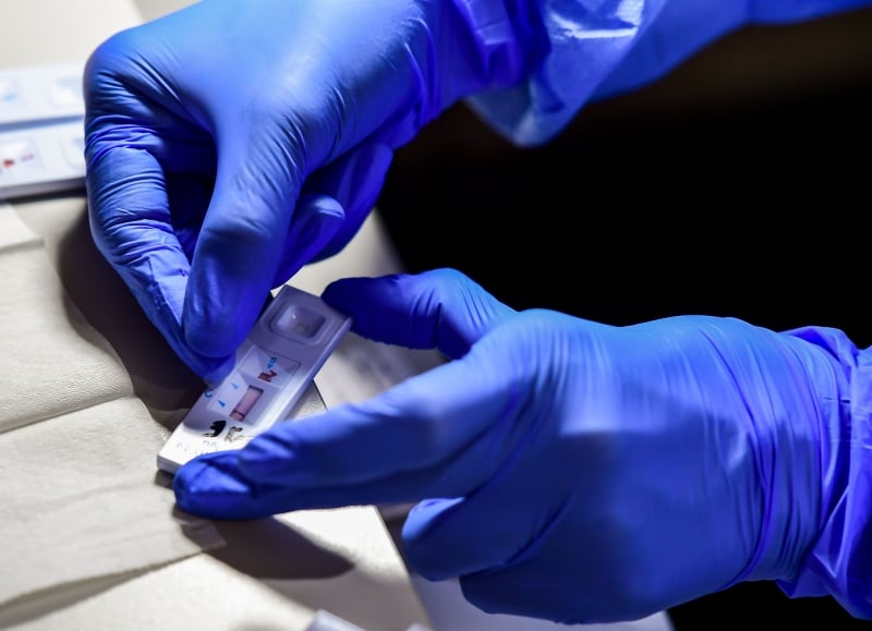 Prefeituras dos municípios gaúchos anunciaram o diagnóstico nesta quarta-feira