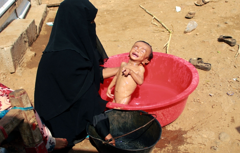 Iêmen é um dos nove países que registraram alta na mortalidade infantil 