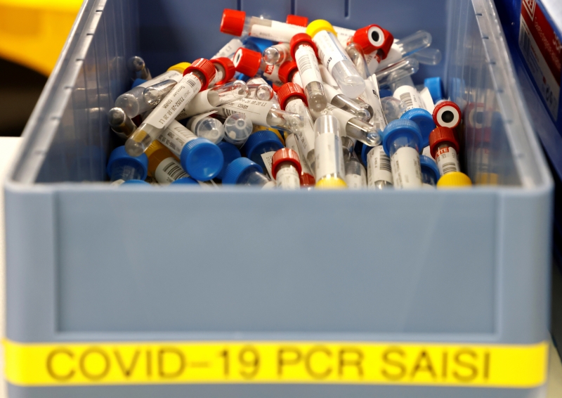 RT-PCR é feito apenas em suspeito que tenha dividido ambiente por mais de 4h com diagnosticado