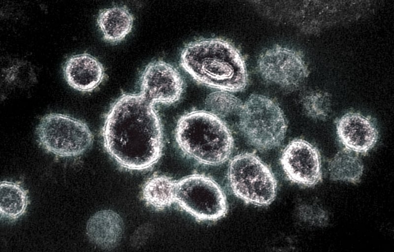 Nos Estados Unidos, pesquisadores desenvolveram uma vacina chamada 'pancoronavírus'