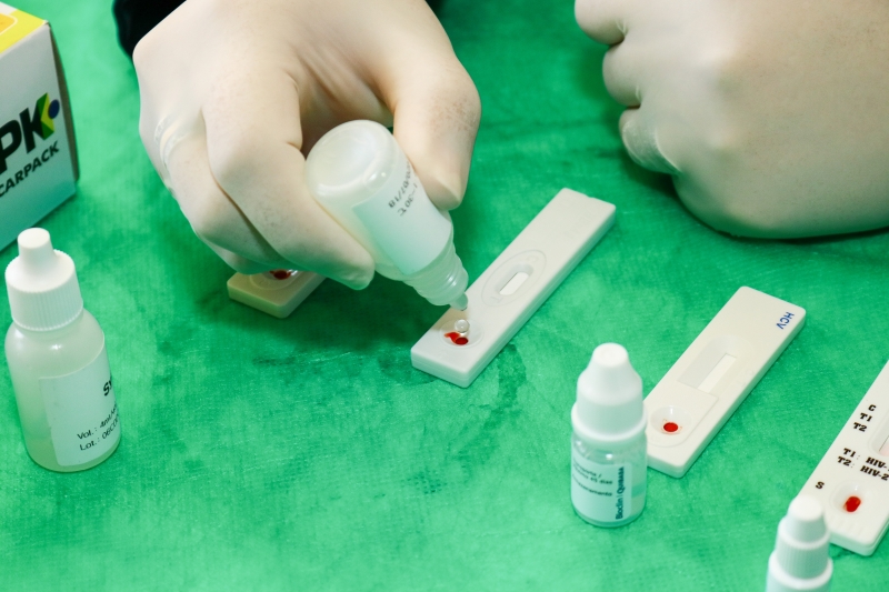 Os resultados do teste rápido saem em cerca de 15 minutos