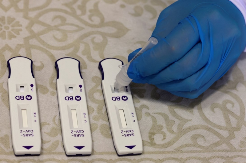 Fiocruz defende análise por PCR para detectar mudança do perfil de circulação do vírus