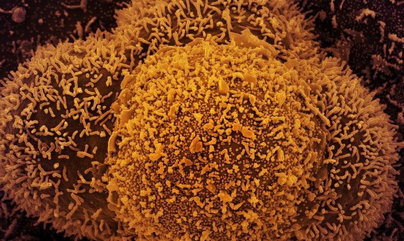 Até o momento, o Brasil tem três casos confirmados da variante Ômicron, todos no Estado de São Paulo