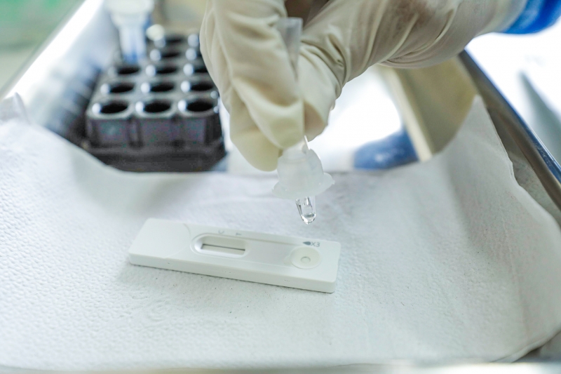 Estado está desabastecido de testes rápidos; situação deve normalizar somente no fim de março