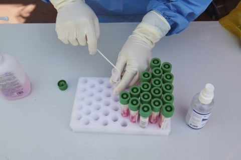 Brasil registra 92 mortes e 12,4 mil casos de Covid