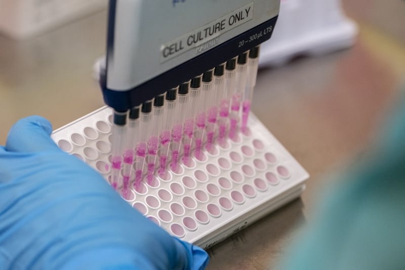 O corte de financiamento também ameaça a permanência da própria Unaids