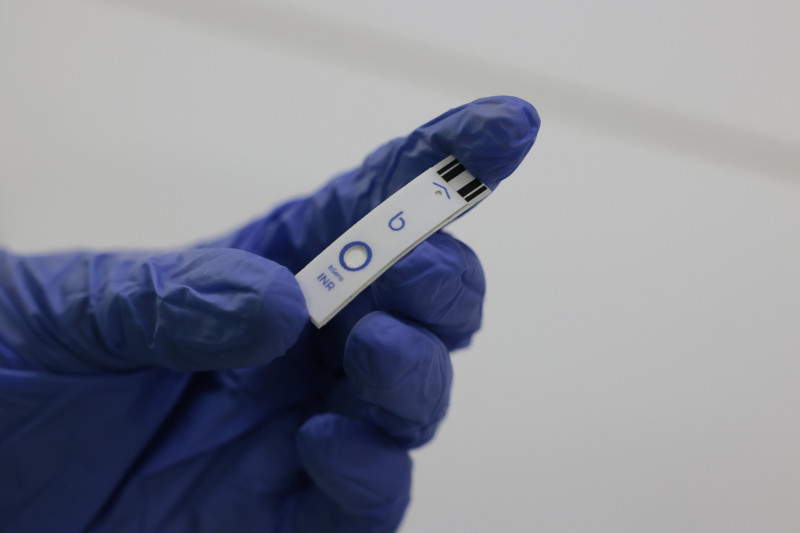 A startup est&aacute; ajustando os &uacute;ltimos detalhes para lan&ccedil;ar, ainda neste ano, testes r&aacute;pidos e port&aacute;teis para medir a coagula&ccedil;&atilde;o do sangue Foto: T&Acirc;NIA MEINERZ/JC