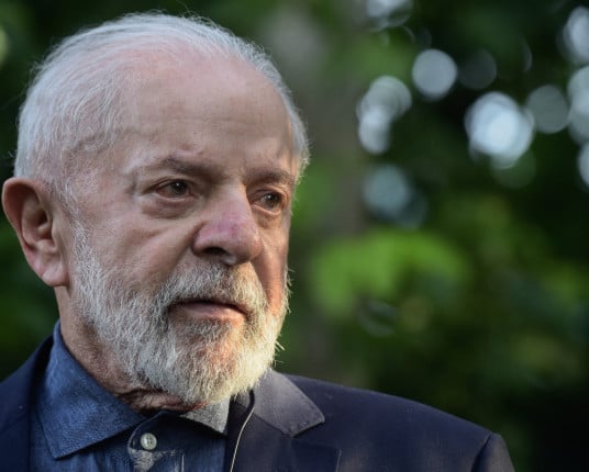 Lula fará procedimento endovascular nesta quinta como complementação da cirurgia