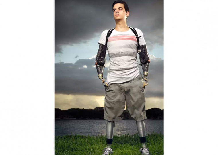 Tetra-amputado que leva uma vida plena, empresário Pedro Pimenta será o primeiro palestrante de 2025