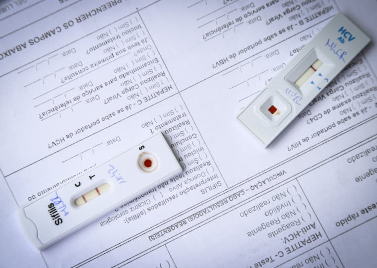  Porto Alegre apresentou 1.321 casos novos de infecção pelo HIV em 2024, representando 43% dos casos do Rio Grande do Sul, sendo 590 casos de HIV e 731 de Aids.
