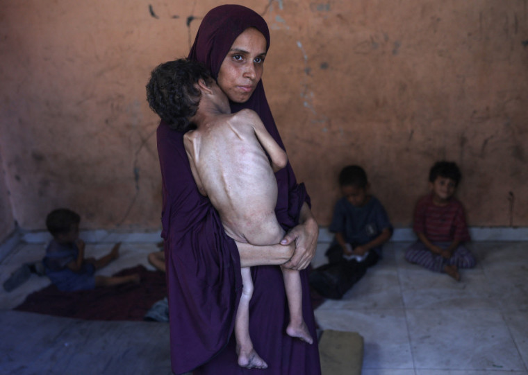 Mais de 30 mil crianças com menos de 5 anos estão em estado de desnutrição aguda, e ao menos 21 já morreram este ano