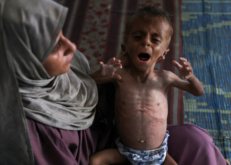 Nos últimos dias imagens de crianças esqueléticas estamparam capas dos principais jornais internacionais