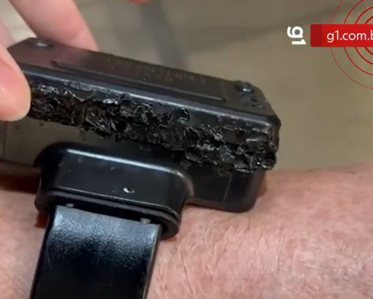 Bolsonaro disse a agente que tentou abrir tornozeleira com 'ferro quente'