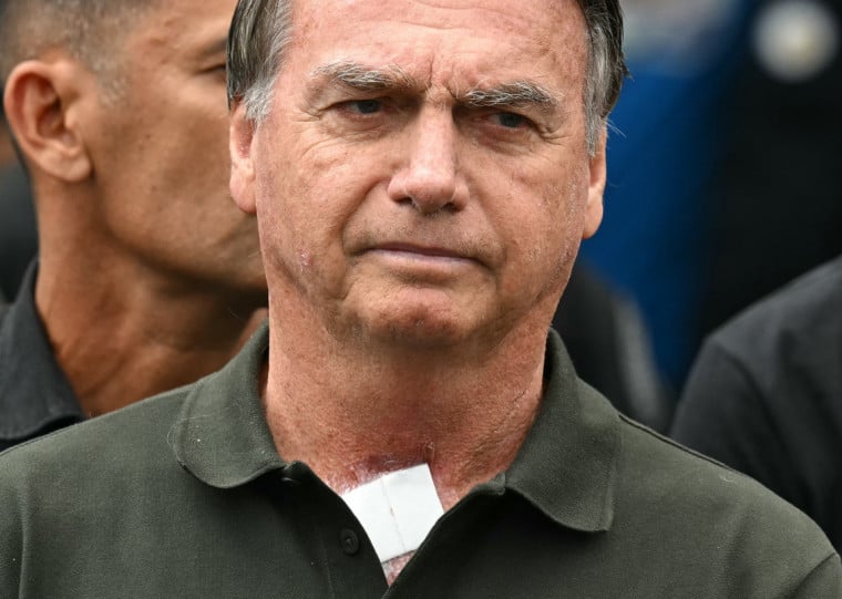 Os advogados de Bolsonaro pediram na última terça-feira (9) autorização para que ele deixe a Superintendência da Polícia Federal para passar por novos procedimentos de saúde