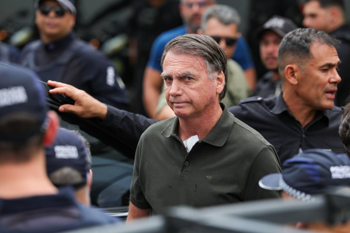 Bolsonaro tem reclamado de dor no ombro direito e médicos indicam cirurgia