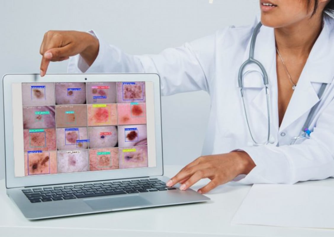 Precis&atilde;o da ferramenta para diagn&oacute;stico foi superior a 80% | Unipampa/Divulga&ccedil;&atilde;o/Cidades