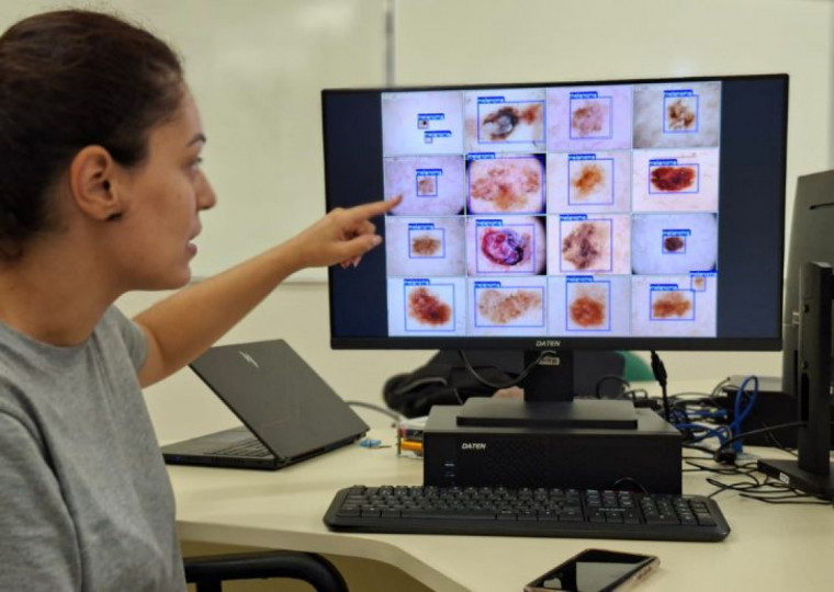 Eduarda Silveira desenvolveu ferramenta de IA para o diagn&oacute;stico de c&acirc;ncer de pele, na Unipampa de Bag&eacute; | Ana Elisandra Freire Campos/Unipampa/Divulga&ccedil;&atilde;o/Cidades