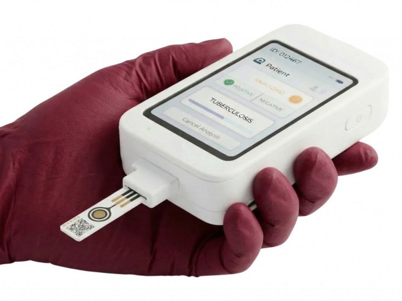 O produto da marca consiste em um dispositivo port&aacute;til de diagn&oacute;stico da tuberculose<br />Foto: Arquivo Pessoal/JC