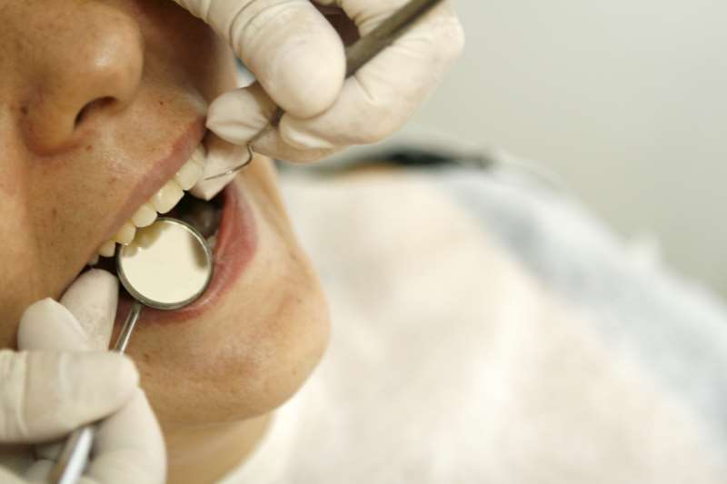 'A boca é um ambiente propício para a proliferação de bactérias', ressalta o cirurgião dentista Kyrillos
