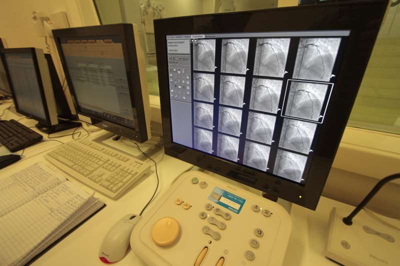 Norma lista os exames de coração a serem apresentados para a obtenção de benefícios