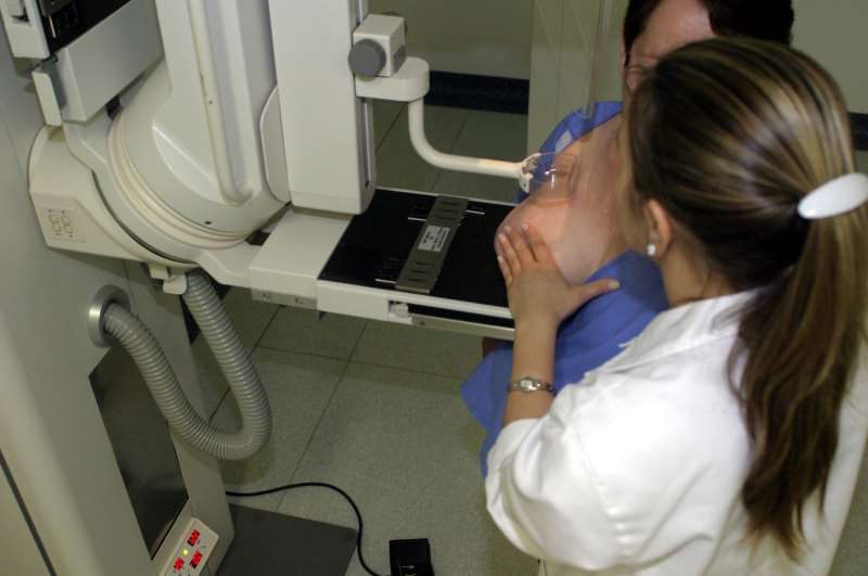 Mamografia periódica é um dos três pilares para o controle da doença
