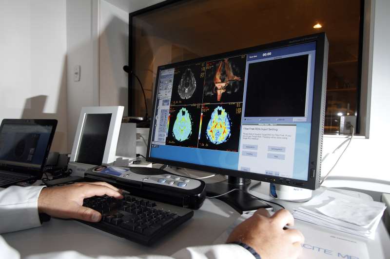 Doença surge com a falha de conexão entre os neurônios; cidade tem 27 casos a cada 100 mil habitantes