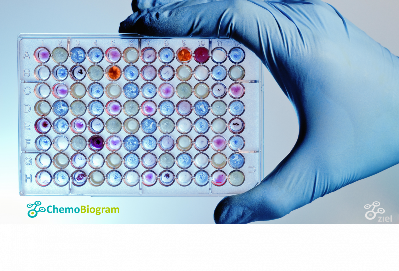 Teste é capaz de avaliar os medicamentos mais eficientes no combate ao câncer